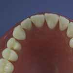 Differentiated Teeth 104