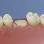 Dentes Diferenciados 139