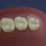 Differentiated Teeth 20