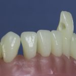 Differentiated Teeth 18