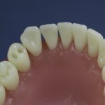 Differentiated Teeth 16
