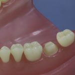 Differentiated Teeth 46