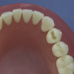 Differentiated Teeth 43