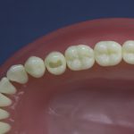 Differentiated Teeth 5